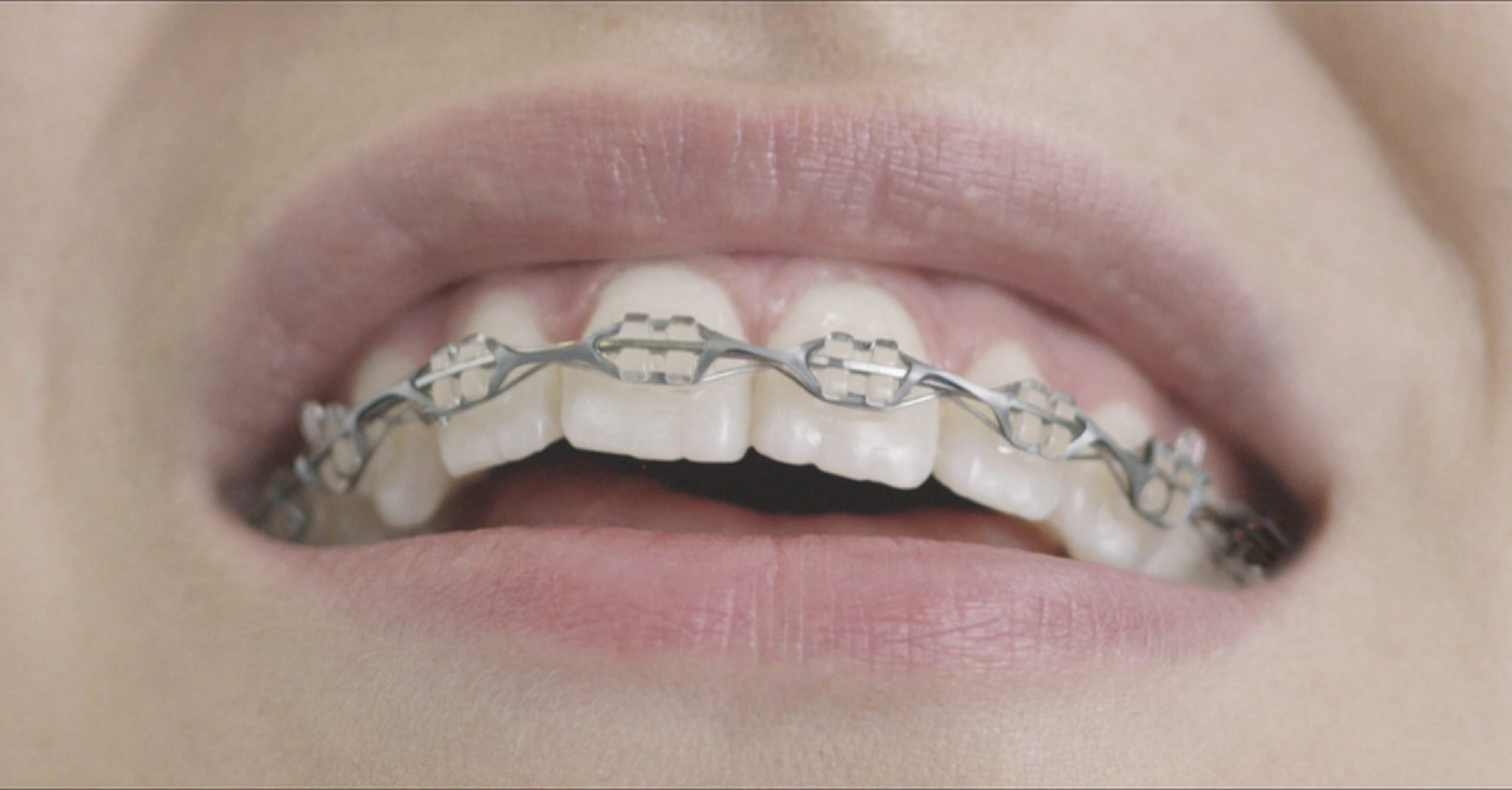 AMAZON - Braces, Hoops, Yoga